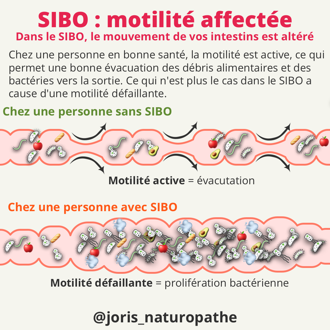 SIBO, complexe moteur migrant