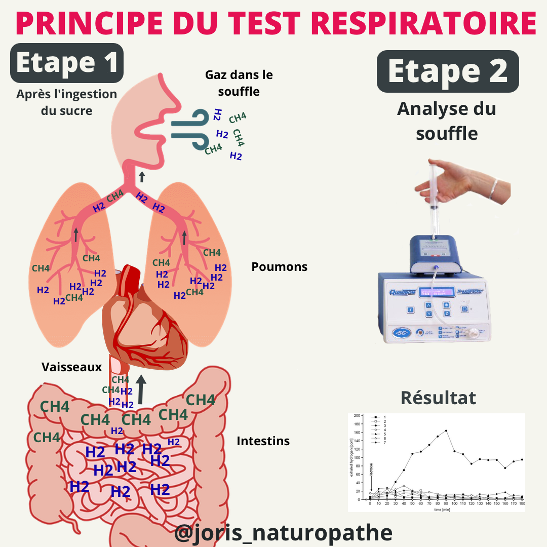 test respiratoire SIBO